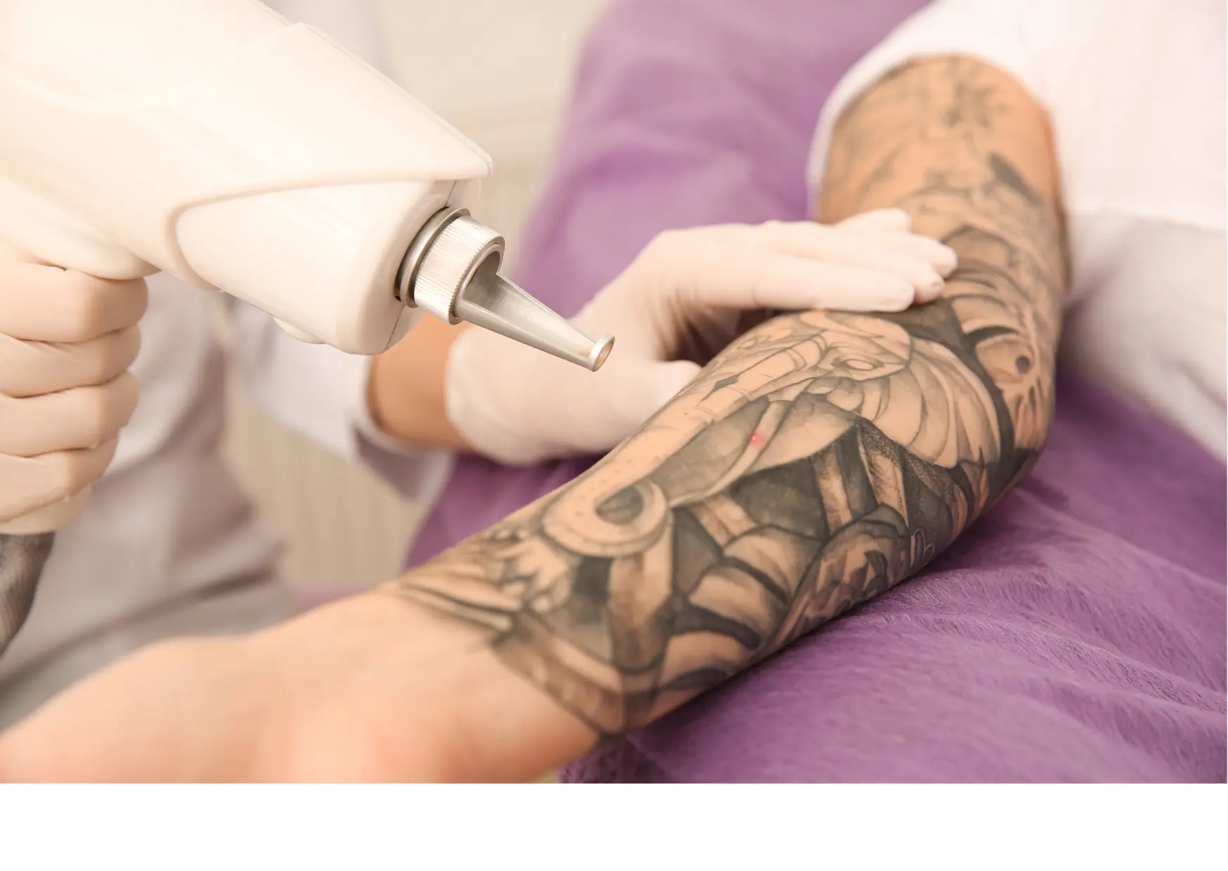 Scarlet RF Łódź | CosinusMED - Centrum Metamorfozy Estetycznej